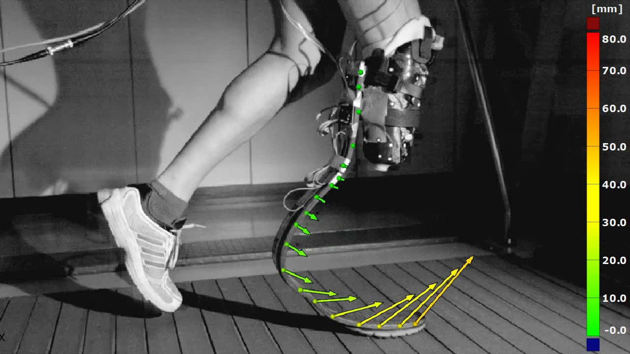 ARAMIS displacement vectors along a runners carbon-fiber prosthetic blade on a treadmill.